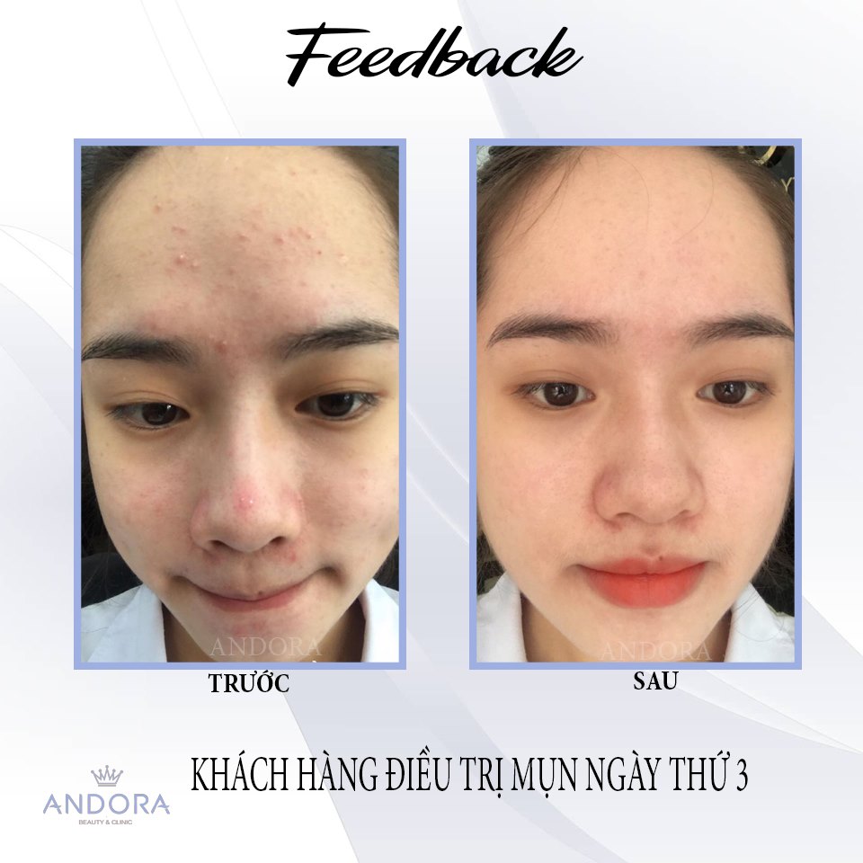 Andora Beauty & Clinic ảnh 2