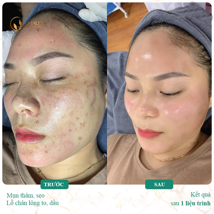 Châu Sa International Clinic & Spa ảnh 2