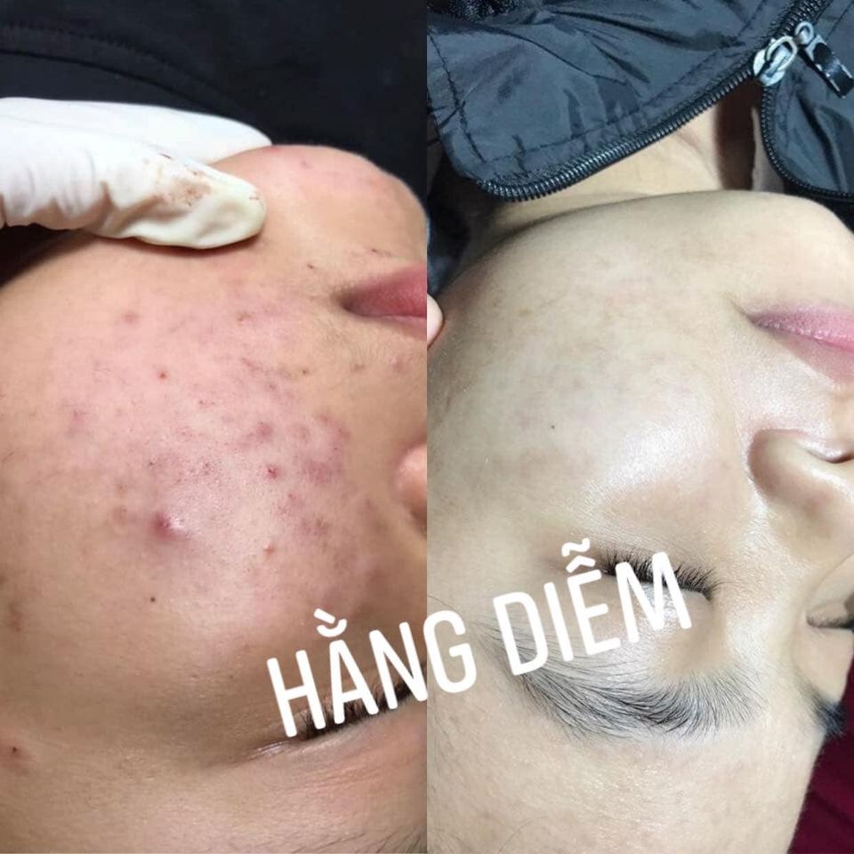 Sline Spa - Hà Tĩnh ảnh 1