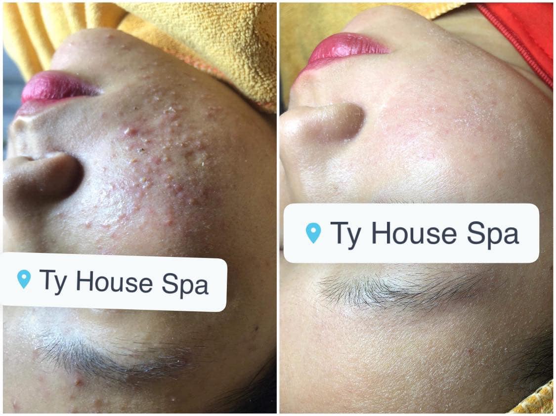 Ty House Spa ảnh 2