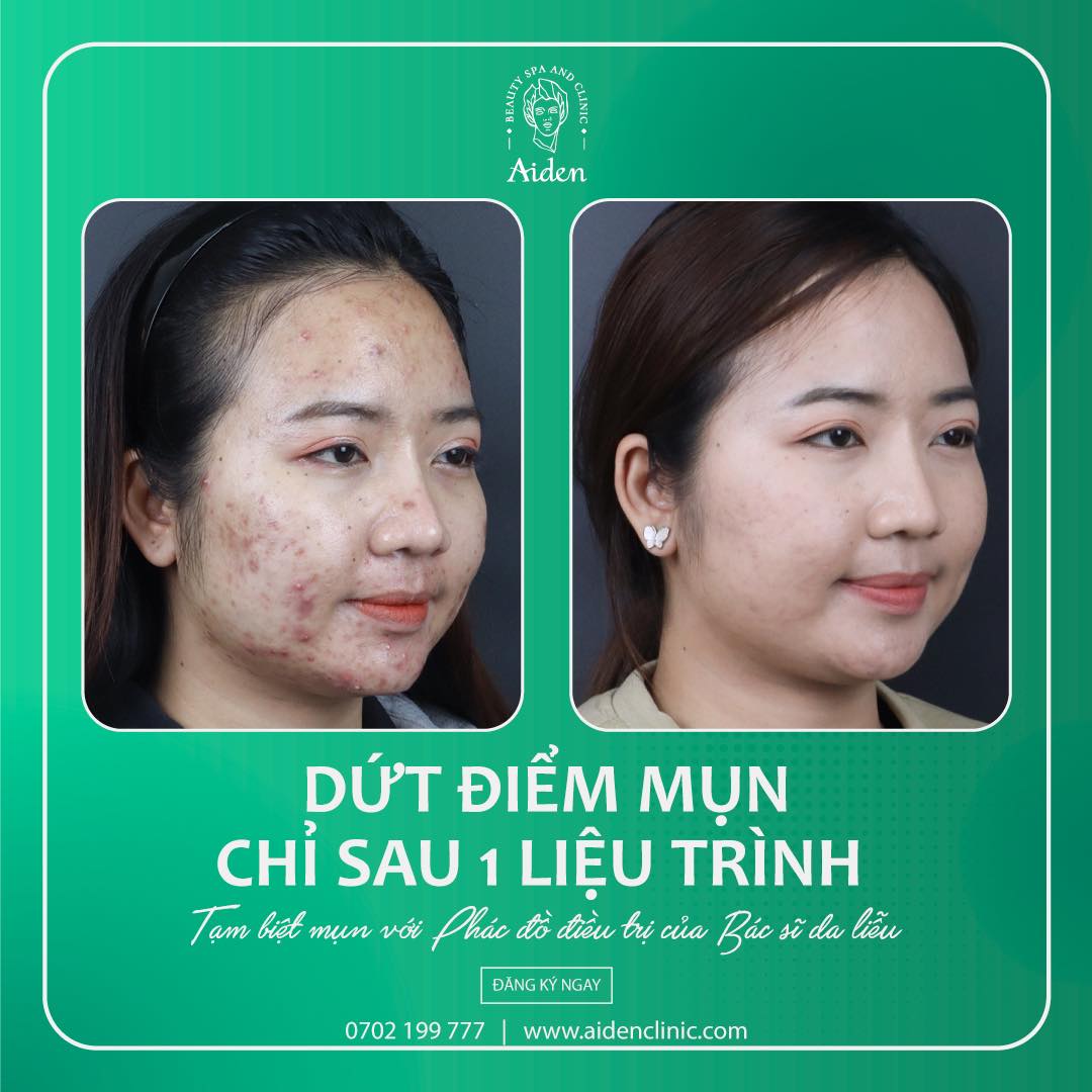 Aiden Beauty Spa & Clinic ảnh 2