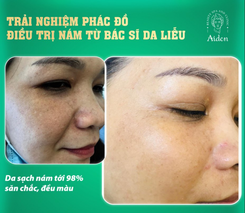 Aiden Beauty Spa & Clinic ảnh 1