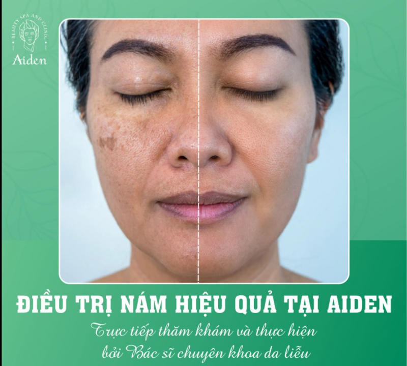 Aiden Beauty Spa & Clinic ảnh 2