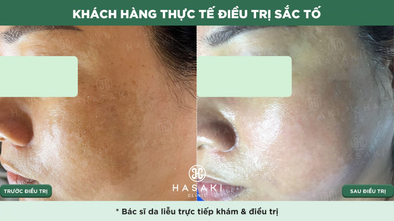 Hasaki Beauty & Clinic ảnh 2