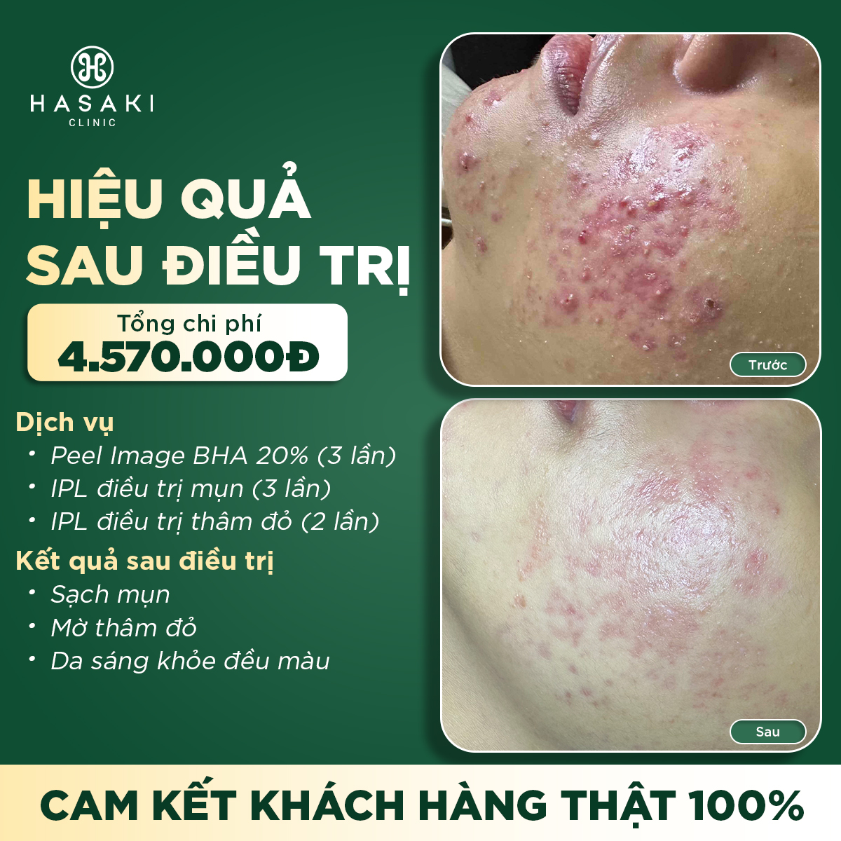 Hasaki Clinic & Spa ảnh 2