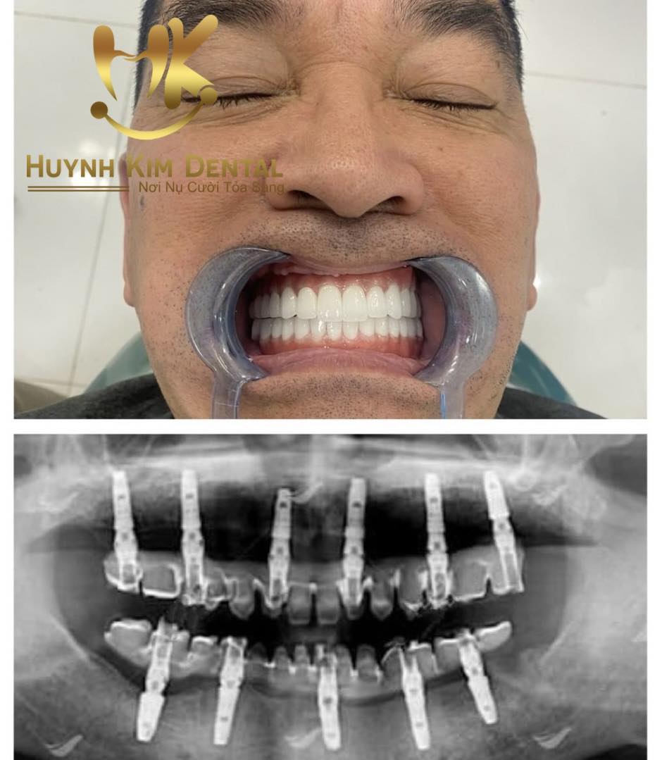 Huỳnh Kim Dental ảnh 2