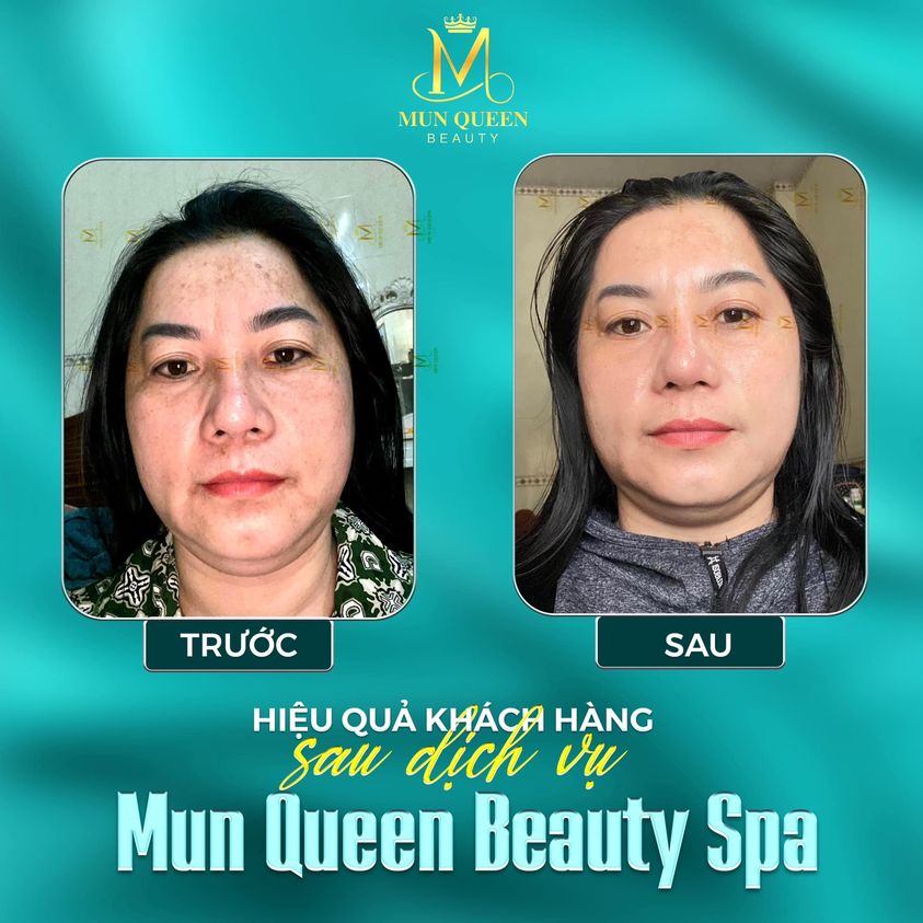 Mun Queen Beauty Spa ảnh 1
