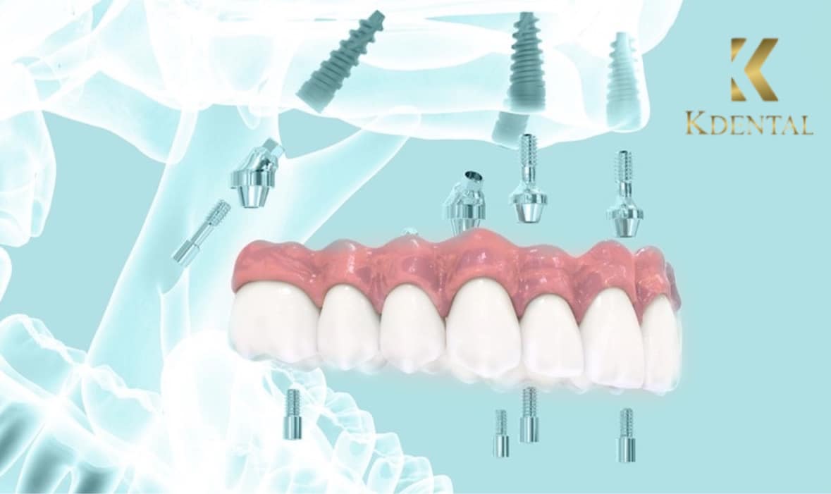 Nha Khoa KDental ảnh 2