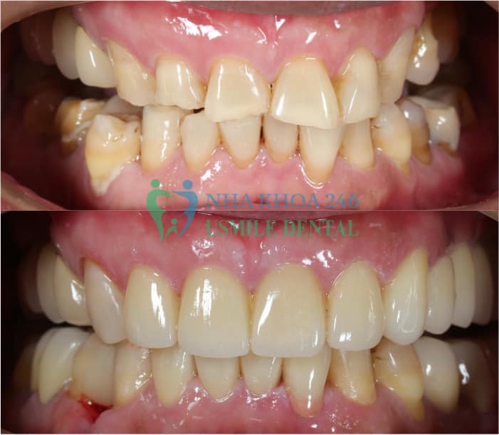 Nha khoa 246 - Usmile Dental ảnh 2