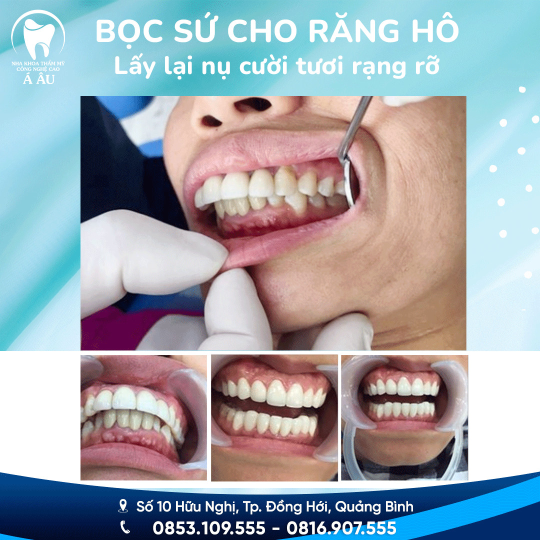 Nha khoa Á Âu Đồng Hới ảnh 1