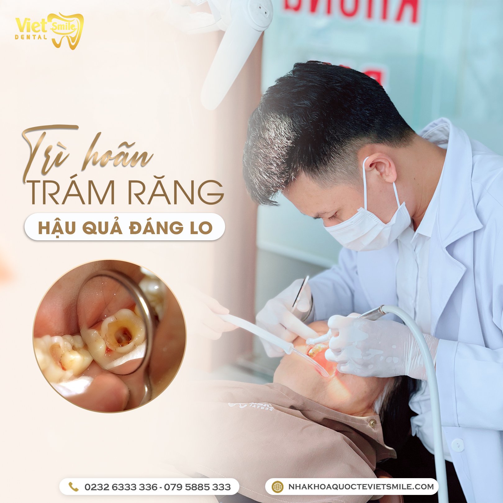 Nha khoa Quốc tế Việt Smile ảnh 1