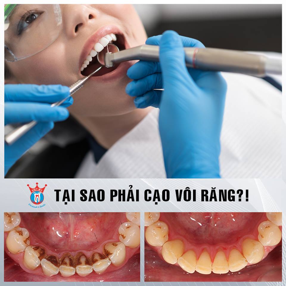 Nha khoa Việt Mỹ ảnh 2