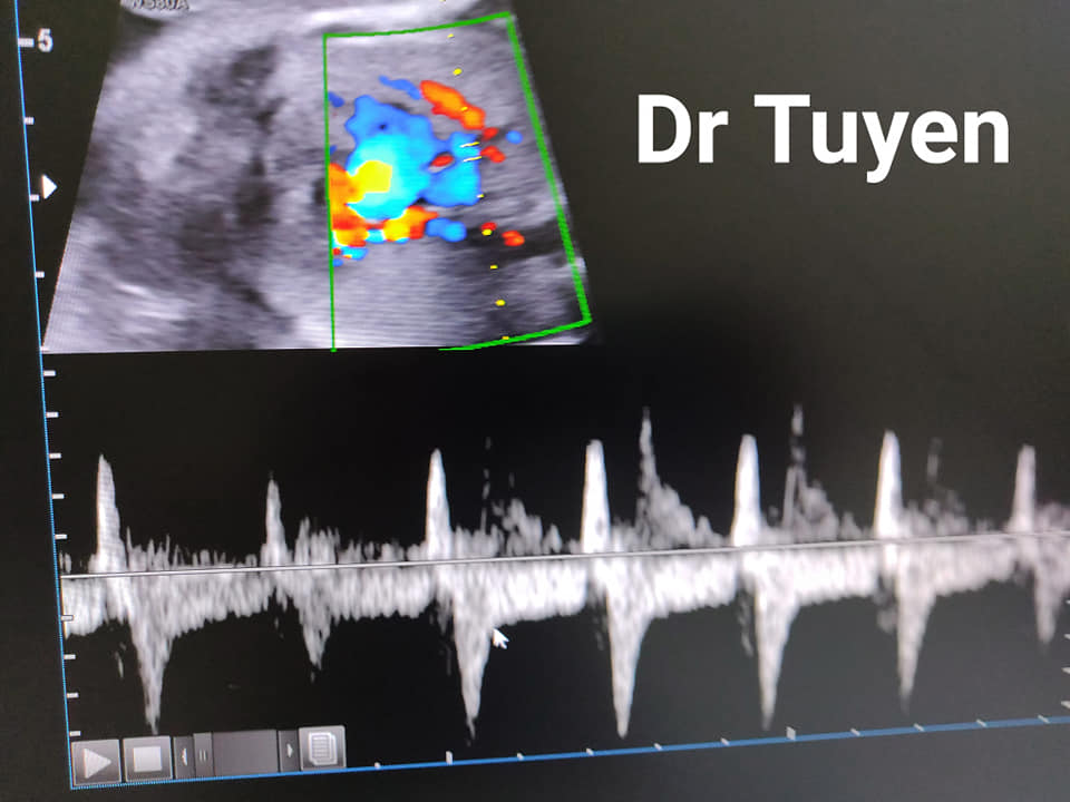 Phòng Siêu Âm Bs Tuyên ảnh 1