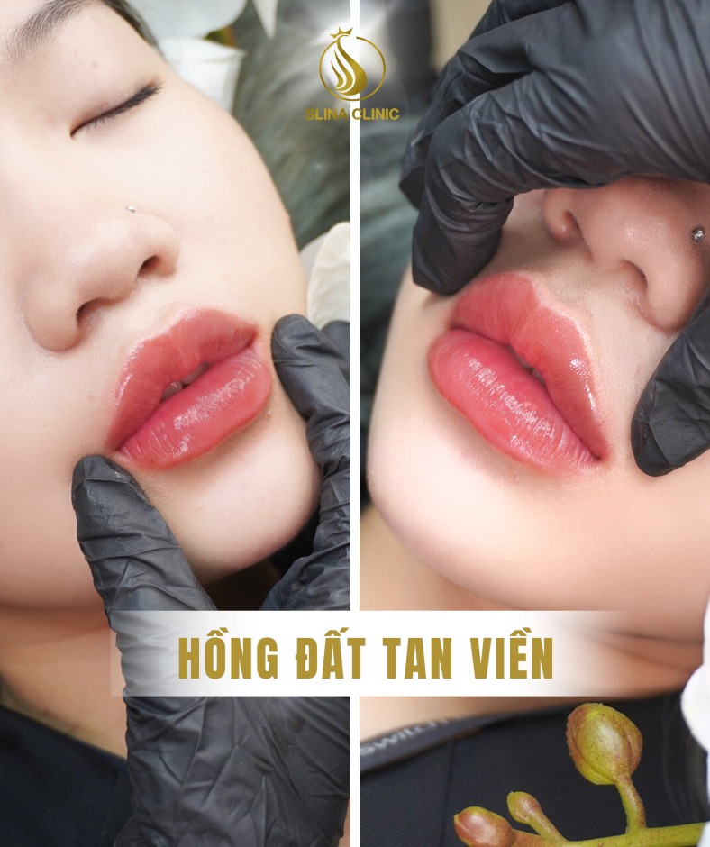 Slina - Thẩm mỹ viện ảnh 2