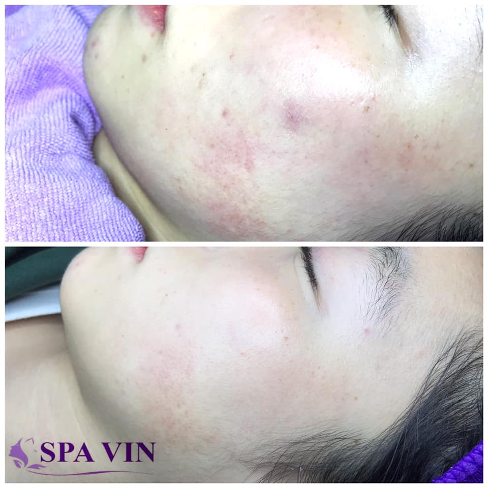 Spa Vin Đà Lạt ảnh 2