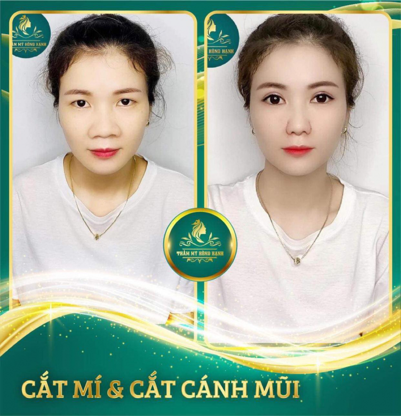 Thẩm Mỹ Hồng Hạnh Đà Nẵng ảnh 1