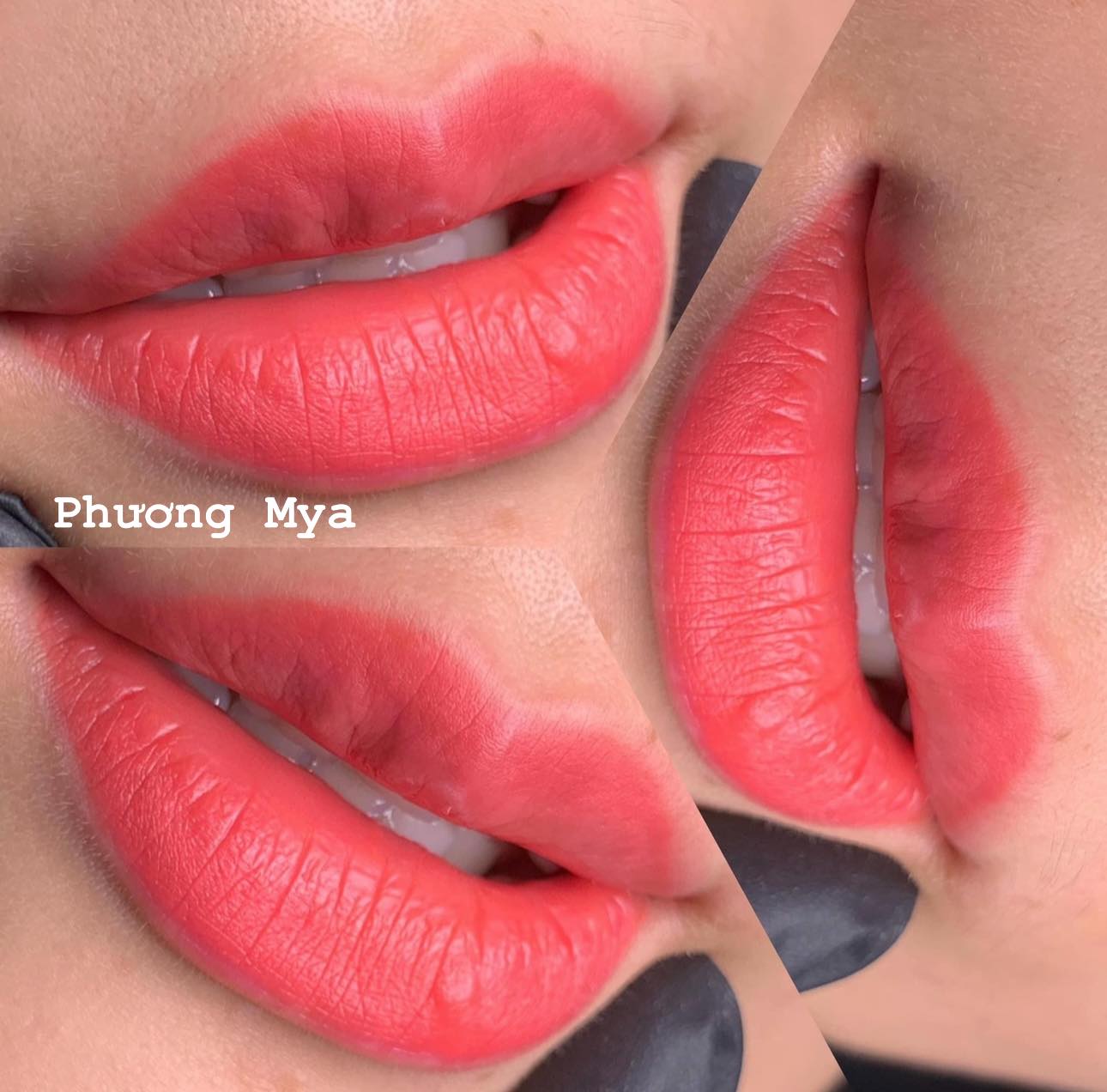 Thẩm Mỹ Quốc Tế Phương Mya ảnh 1