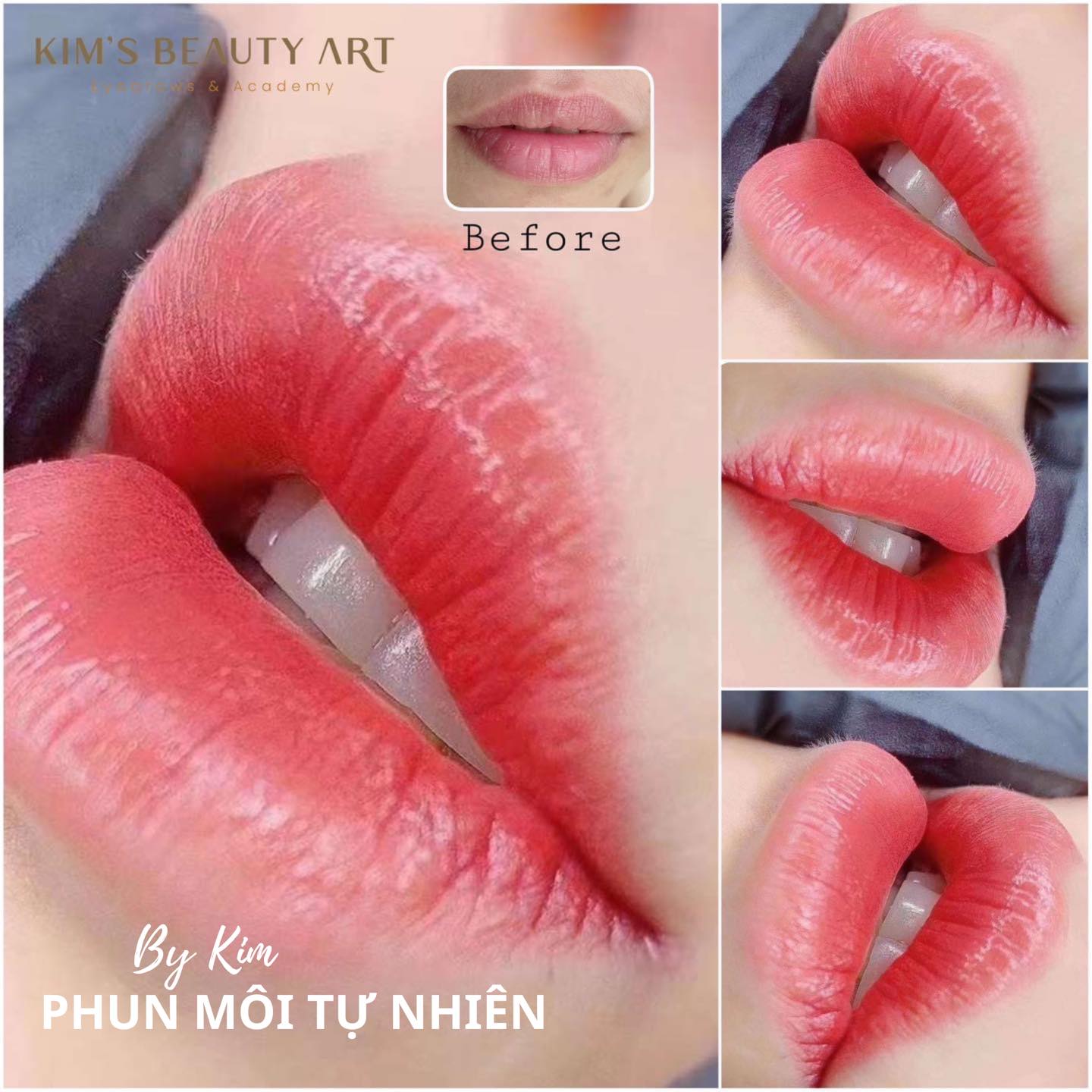 Viện Thẩm Mỹ KIM ảnh 1