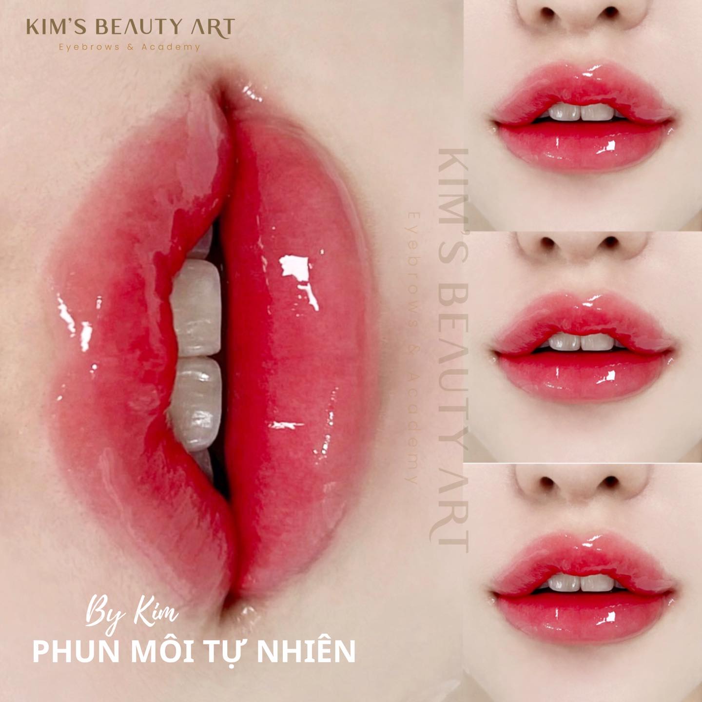 Viện Thẩm Mỹ KIM ảnh 2