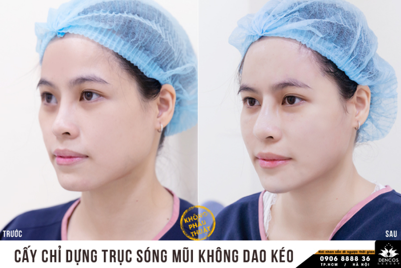 Viện Thẩm Mỹ Quốc Tế Dencos Luxury ảnh 2