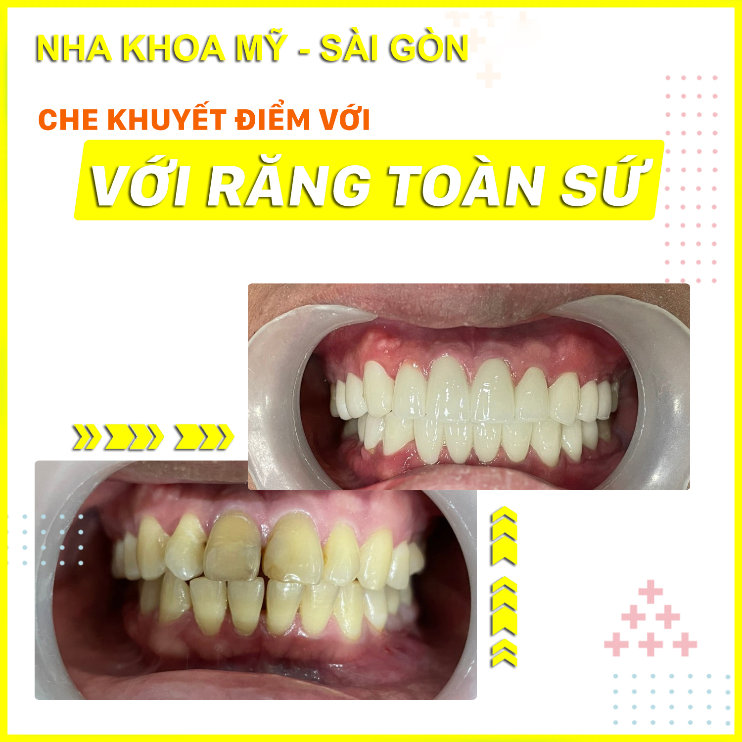 Nha Khoa MỸ SÀI GÒN ảnh 3