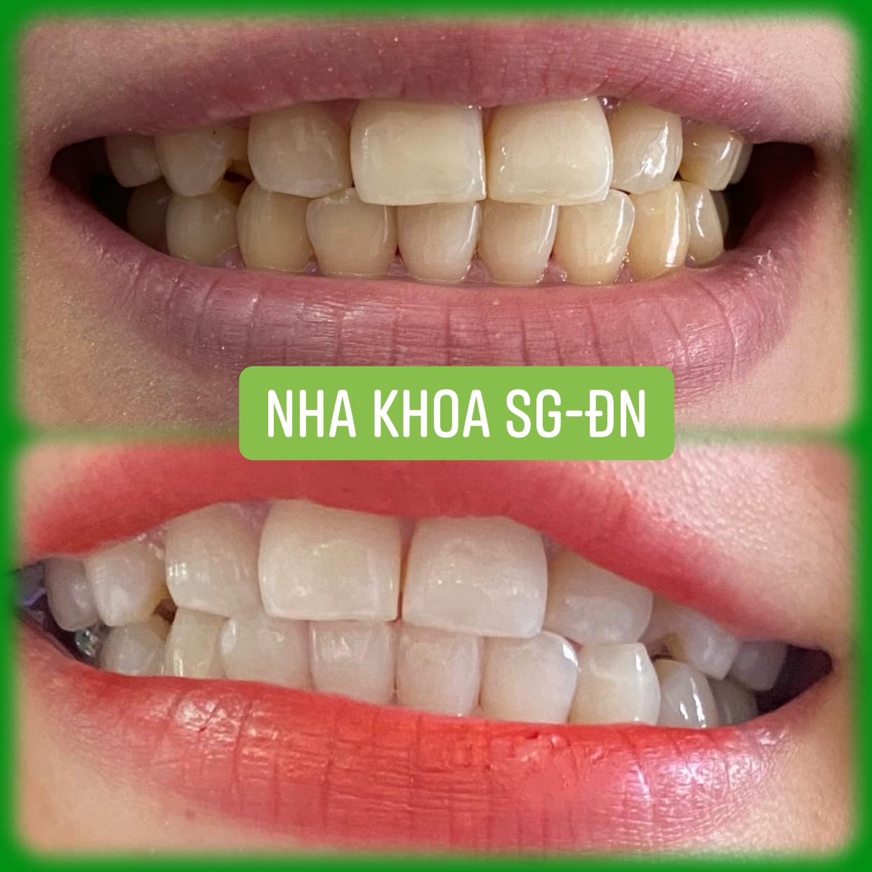 Nha Khoa Sài Gòn ảnh 3