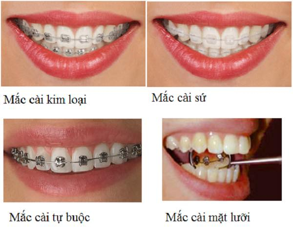 Nha Khoa Uy Tín Toàn Mỹ ảnh 2