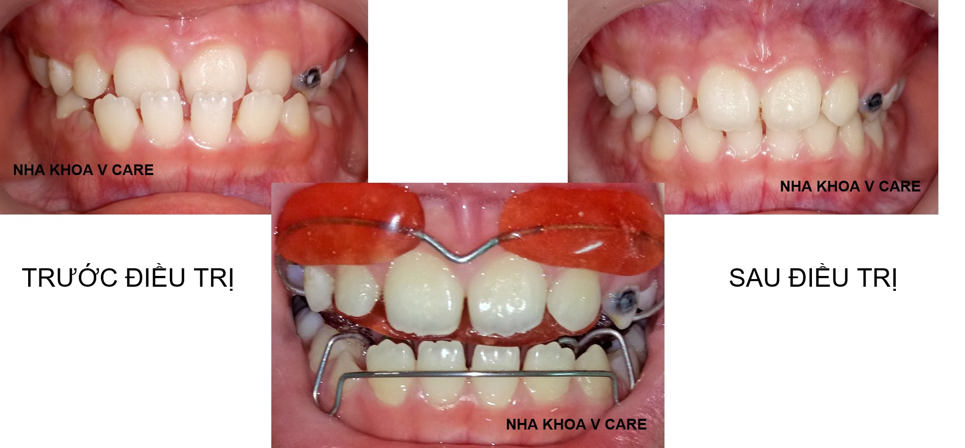 Nha Khoa Vcare ảnh 3