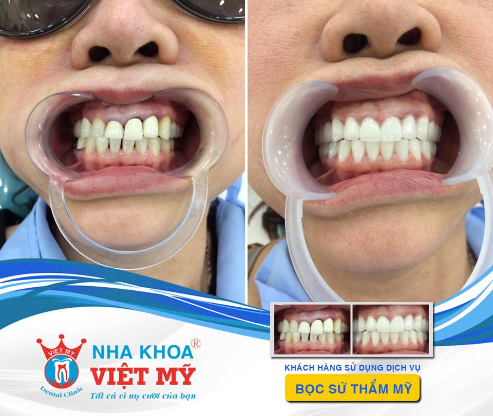 Nha Khoa Việt Mỹ ảnh 2