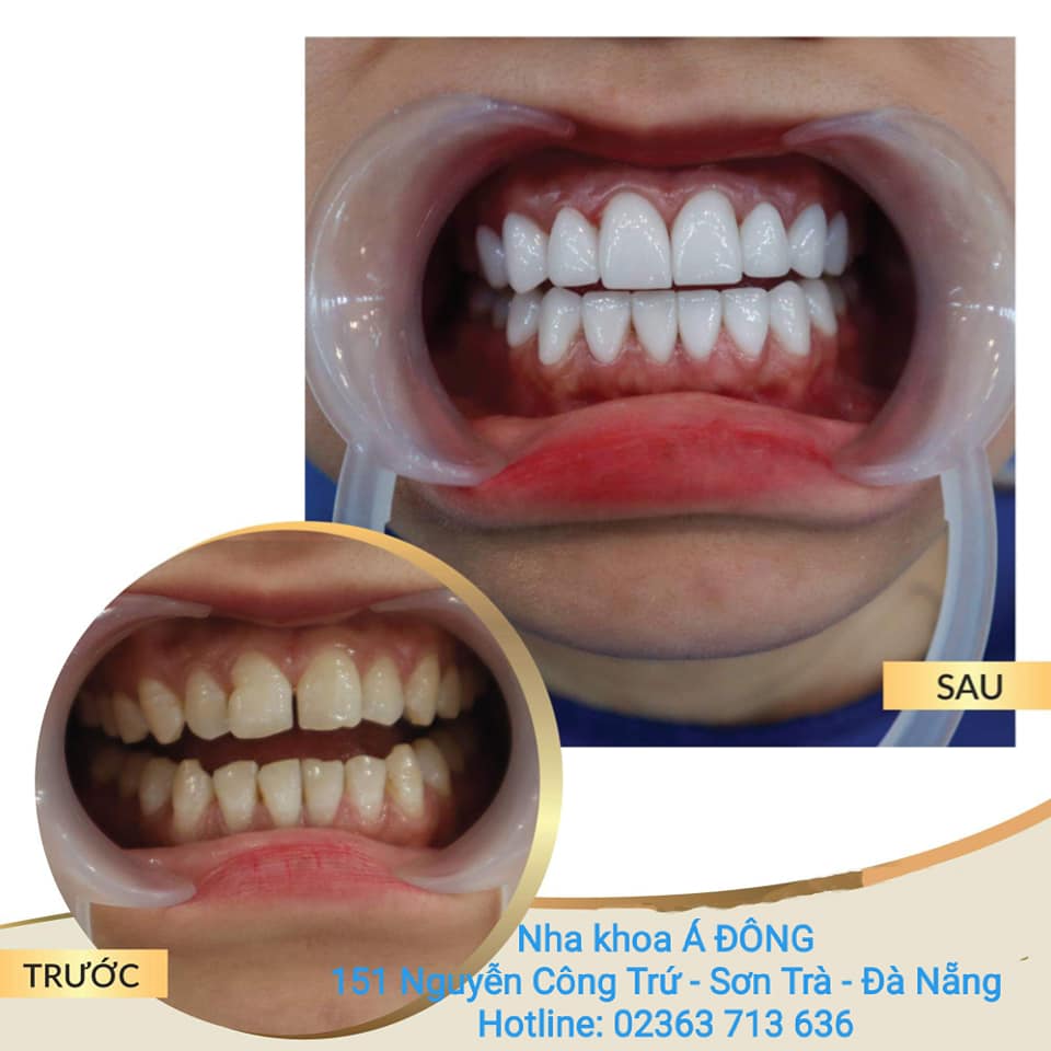 Nha khoa Quốc tế Á Đông ảnh 3