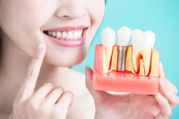 Nha khoa trồng răng implant uy tín nhất Hải Dương