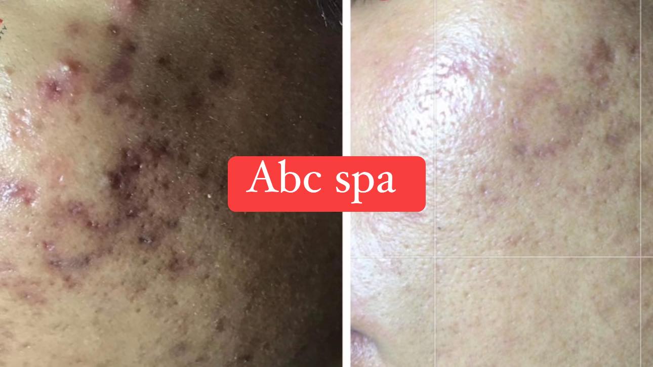 ABC Spa & Clinic Vĩnh Long ảnh 2