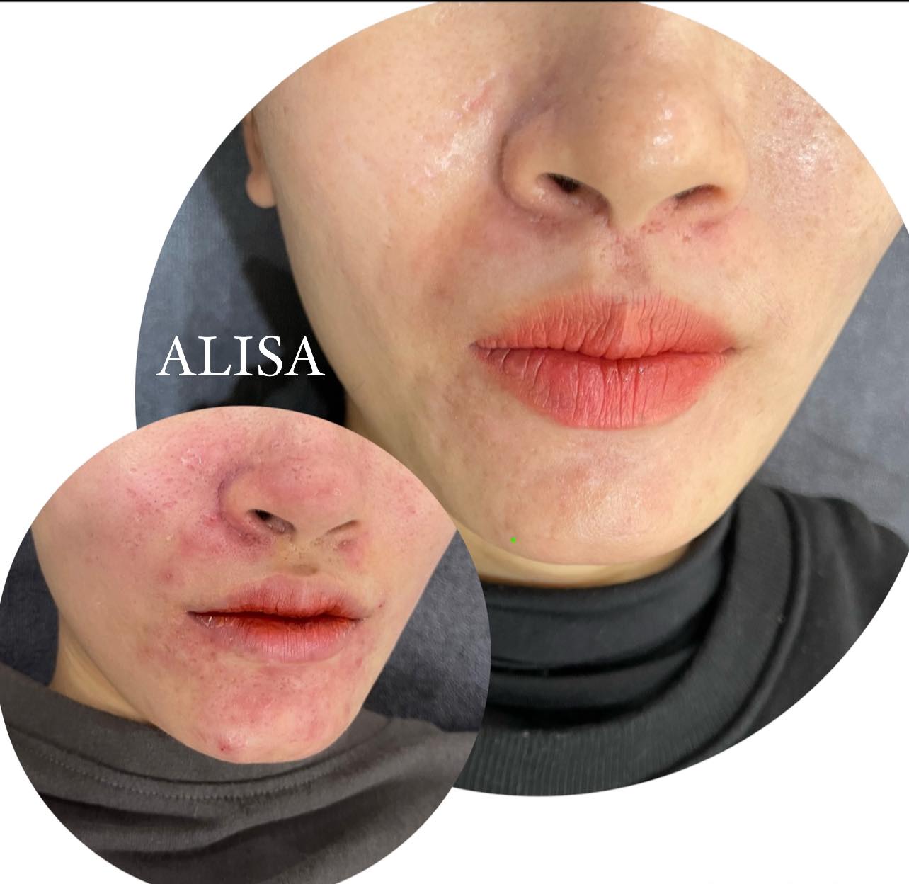 ALISA Beauty & Skincare ảnh 2