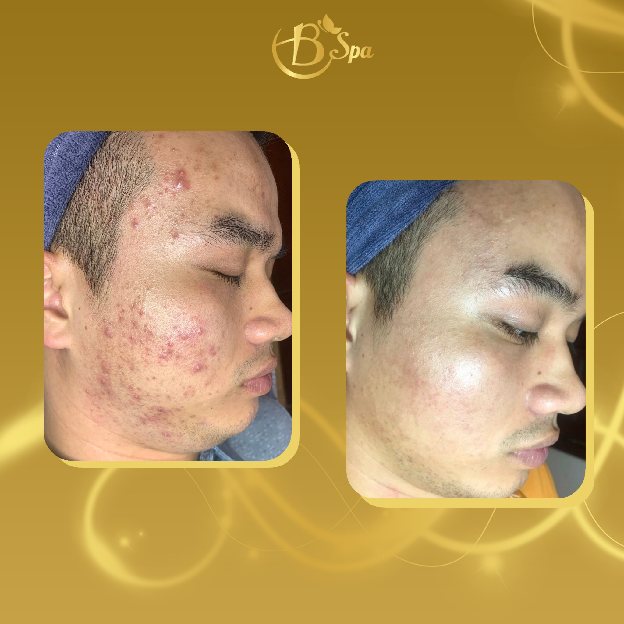 B Spa Đà Nẵng ảnh 2