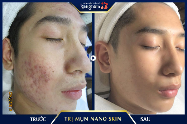 Bệnh viện thẩm mỹ Kangnam ảnh 2