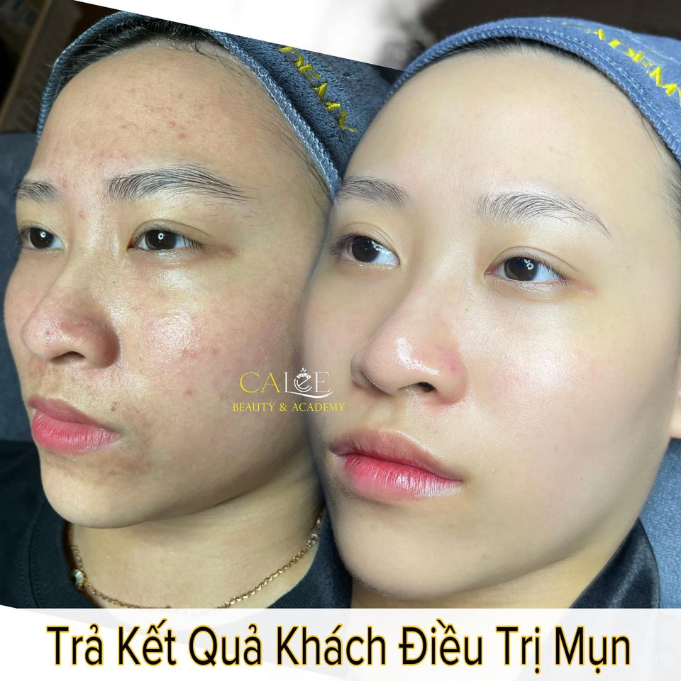 Calee Spa - Thẩm Mỹ Viện TP Vĩnh Long ảnh 1