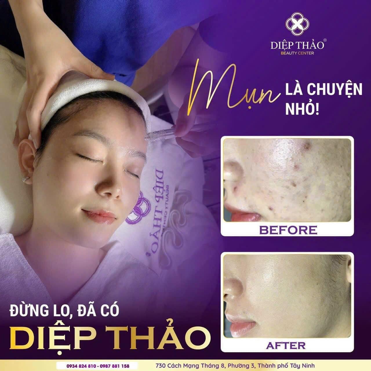 DIỆP THẢO MEDI-SPA ảnh 1