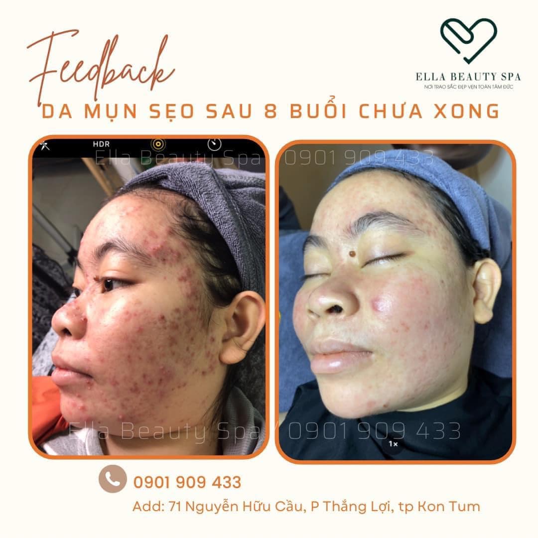 ELLA BEAUTY SPA ảnh 2