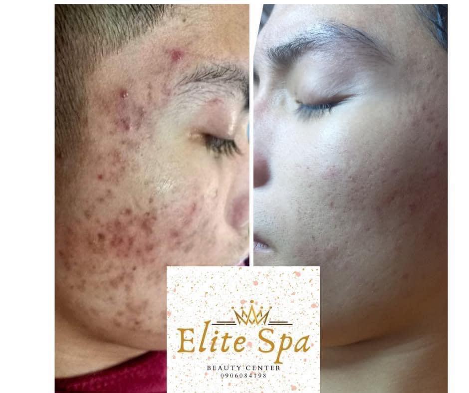 Elite spa ảnh 1