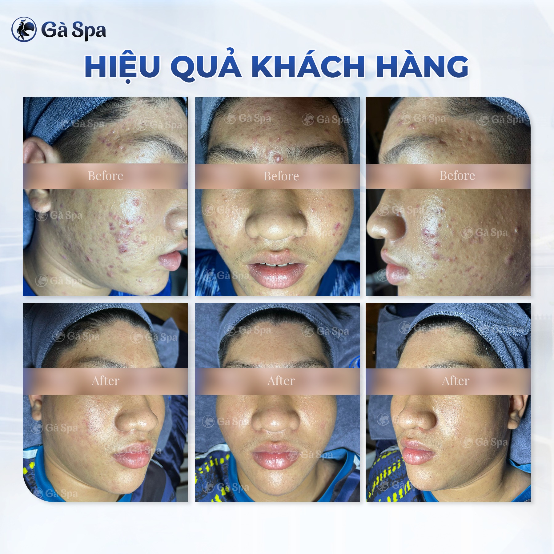 Gà Spa Bến Tre ảnh 2