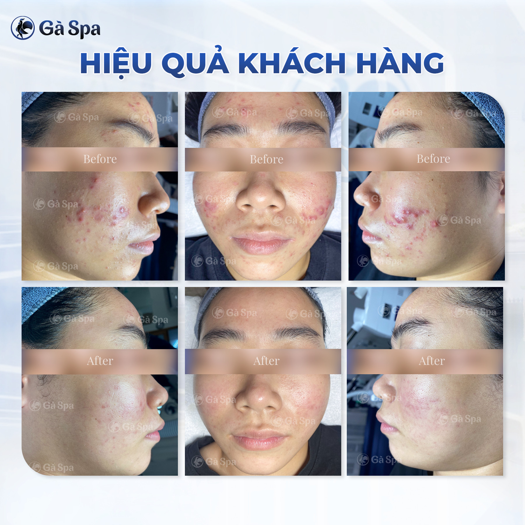 Gà Spa Biên Hòa ảnh 2