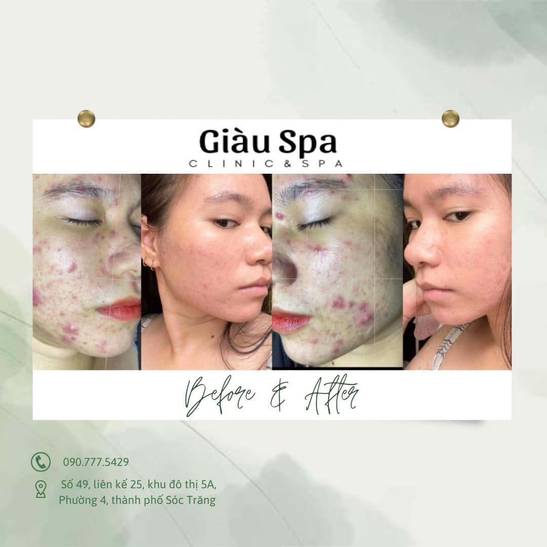 Giàu Spa Sóc Trăng ảnh 1