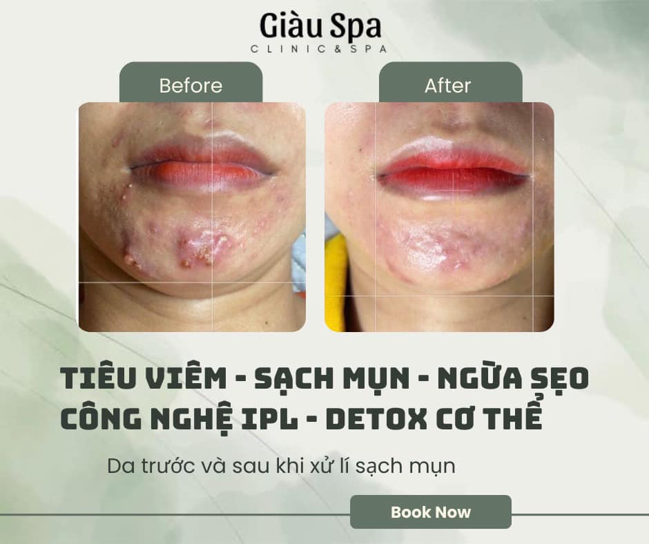 Giàu Spa Sóc Trăng ảnh 2