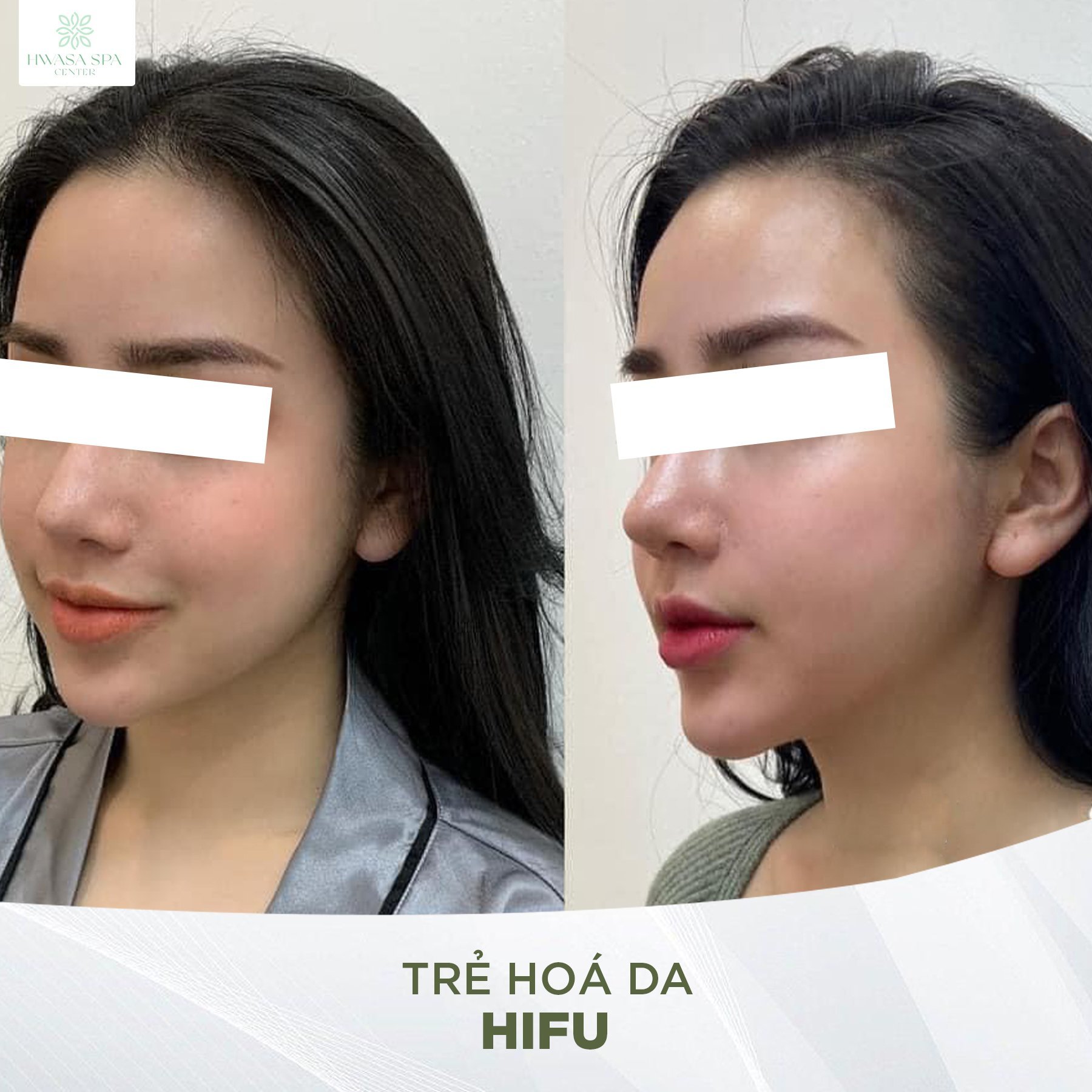 HWASA Spa Center ảnh 3