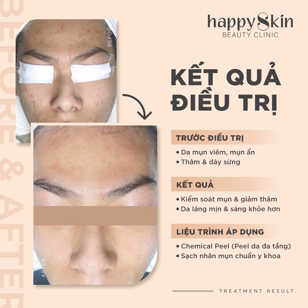 Happy Skin Beauty Clinic ảnh 1