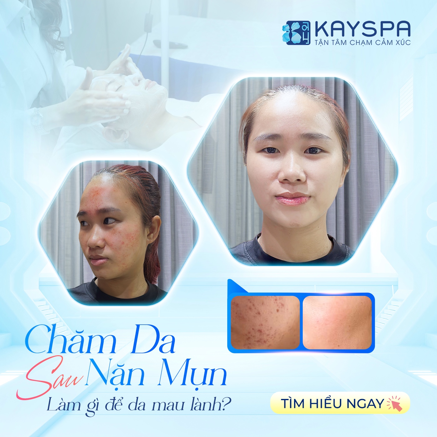 KAY SPA TÂY NINH ảnh 2