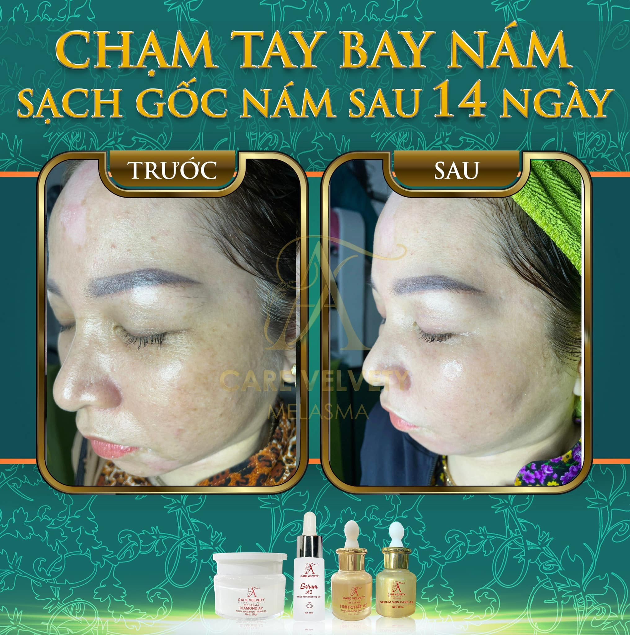 Kim Ngân Spa ảnh 1