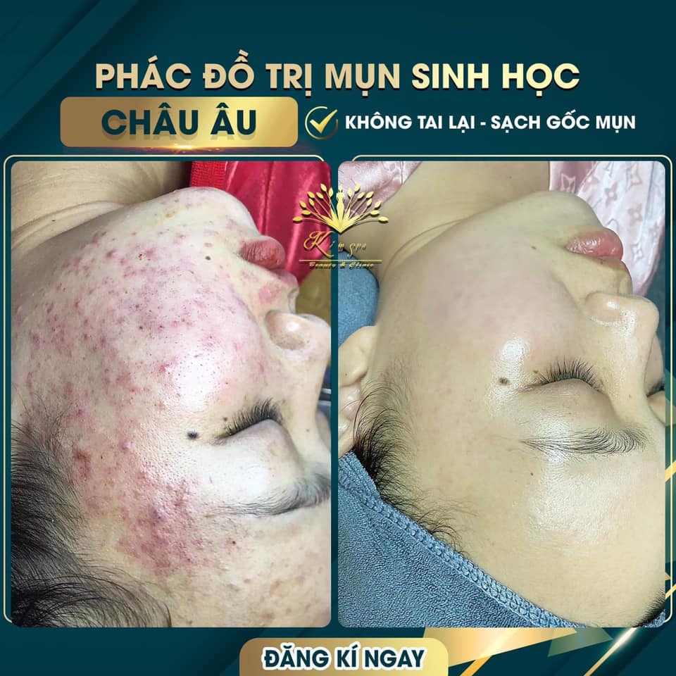 Kim Spa Tây Ninh ảnh 1