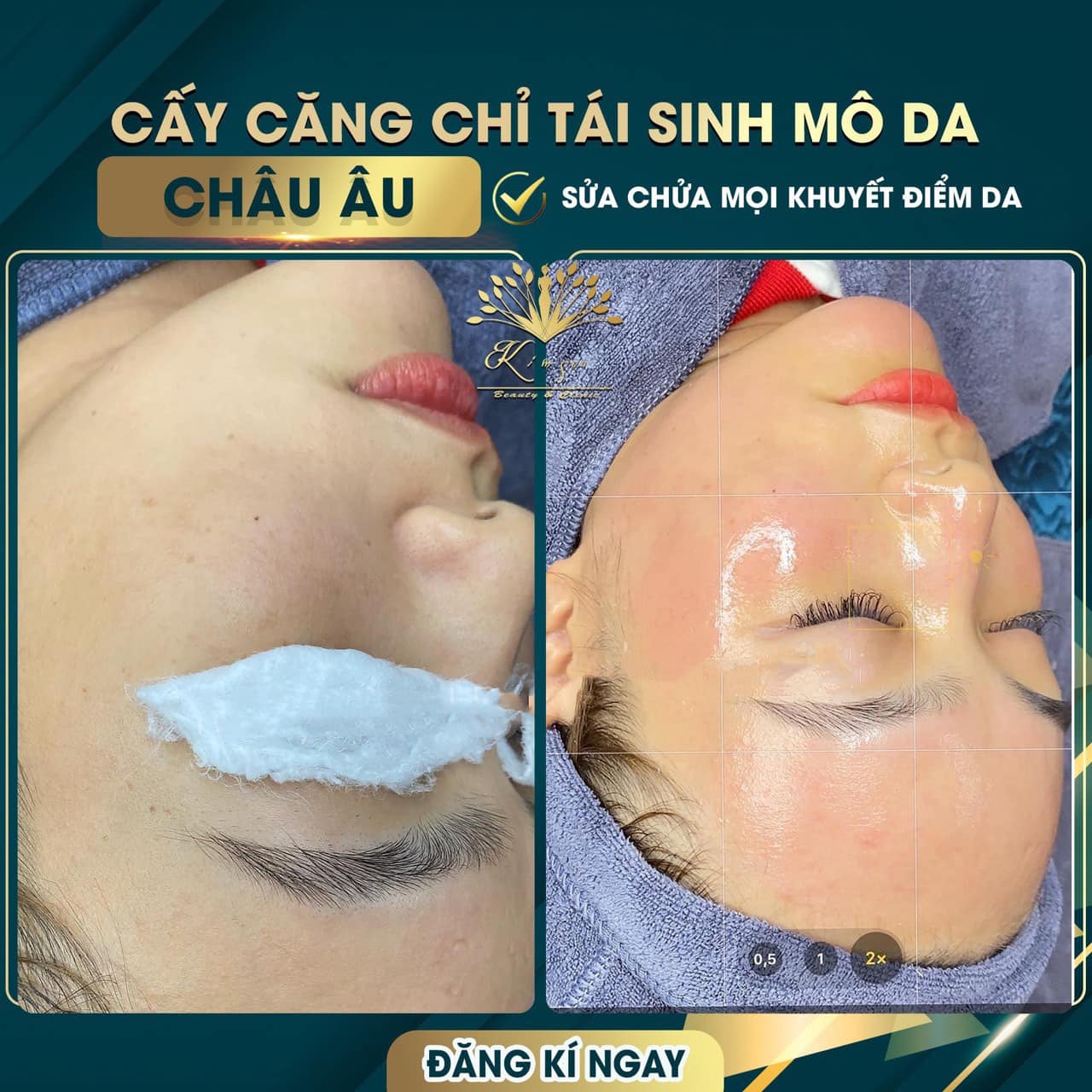 Kim Spa Tây Ninh ảnh 2