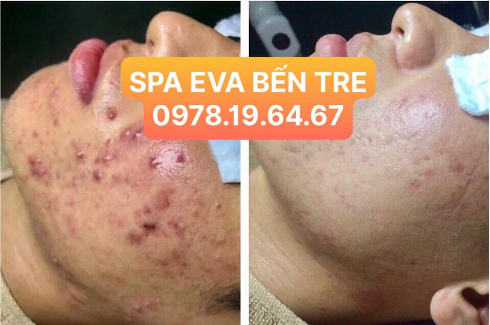 Mỹ Tiên Spa Bến Tre ảnh 2